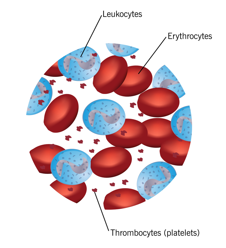 Anemia Medical English